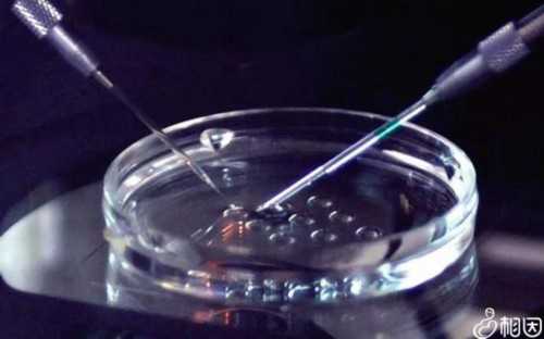 代生小男孩:稽留流产的流产方式有什么