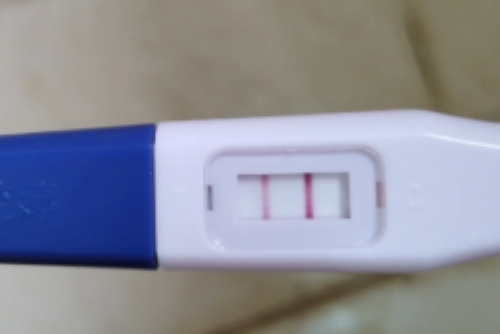 供卵代孕服务_试管代孕公司哪家好,试管婴儿移植使用胚胎胶利弊分析，想提高