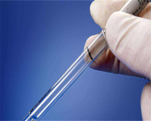 超雄综合征xyy做试管_超雄综合症可以要孩子吗