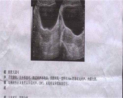 北京试管代生借卵生子机构可以签约吗？2026北京试管代生借卵成功率了解下