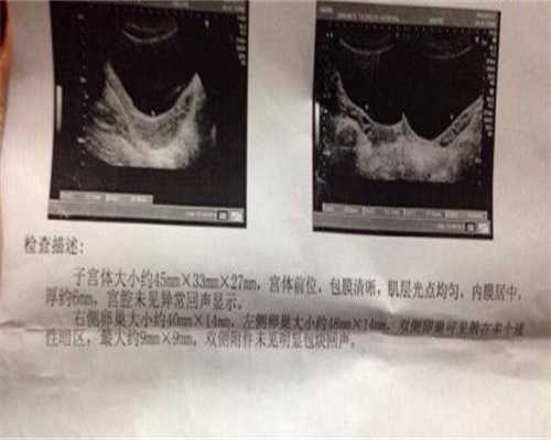 南宁友爱医院试管婴儿怎么样(南宁市友爱医院医生简介)