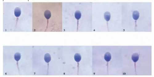试管婴儿代孕哪个机构好_代孕哪家专业,
              胚胎绒毛染色体检查结果怎
