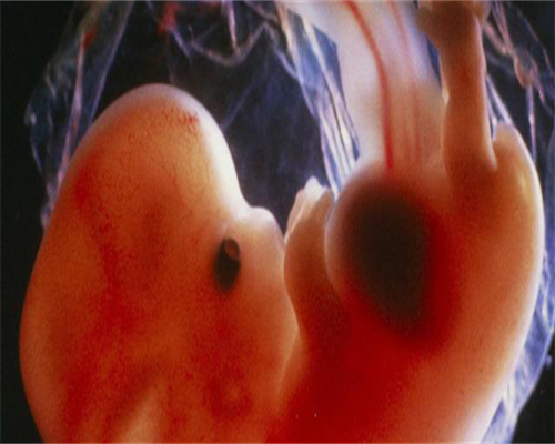 中国捐卵代怀_哪里可以做供卵试管代孕,有哪些宫腔粘连的诊断方法？