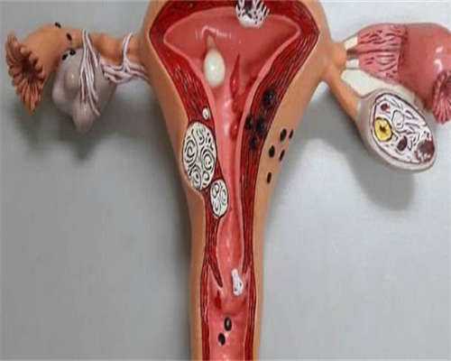 供卵机构助孕:在国内可以做试管婴儿生混血儿宝宝吗？