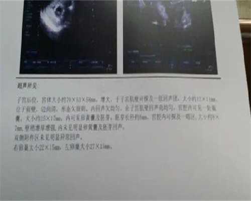 供卵医生电话:上海那家医院做试管婴儿最有权威？