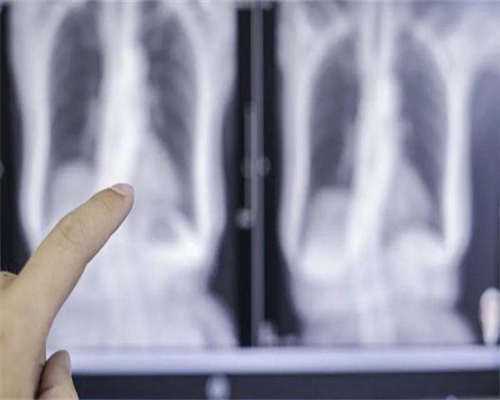 卵巢囊肿闭经怎么处理比较好